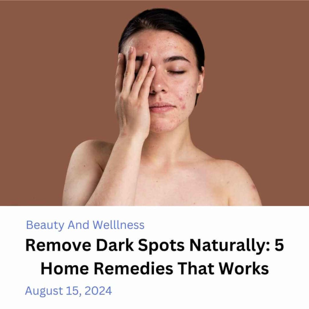 Remove dark spots naturally